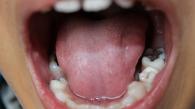 科大破解人类口腔微生物合成次生代谢小分子促进牙菌斑形成的奥秘